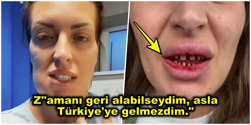 Uygun Fiyata Hollywood Gülüşü Yaptırmak İçin Ülkemize Gelen Kadın Türkiye'ye Geldiğine Bin Pişman Oldu!