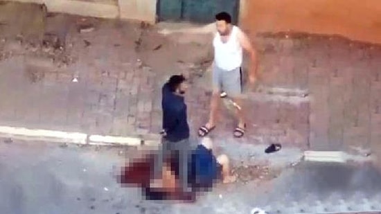 Antalya’da Vahşet: Sevgilisinin Boğazını Kesti, Başında Bekleyerek Kimseyi Yaklaştırmadı