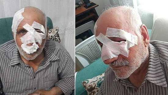 Köpek Saldırısına Uğramıştı: 54 Günlük Yaşam Mücadelesini Kaybetti