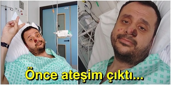 Maymun Çiçeği (Monkey Pox) Virüsüne Yakalanan Harun Hastalıkla İlgili Detayları ve Görüntüsünü Paylaştı