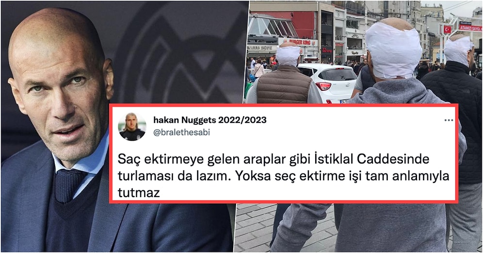 Aklı Kelden Alamayacağız: Yılların Keli Zidane'ın İstanbul'da Saç Ektirdiği İddiası Goygoycuların Diline Düştü