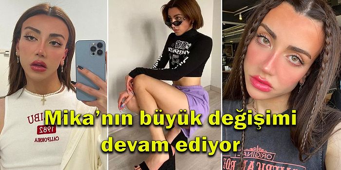 TikTok Fenomeni Mika Raun Yaptırdığı Sayısız Estetiklerine Yenisini Ekledi: Göğüs ve Popo Ameliyatı Oldu!