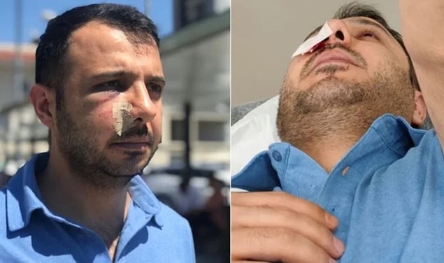 Olay, 4 Temmuz'da akşam saatlerinde Bağcılar Eğitim Araştırma Hastanesi'nde yaşandı.