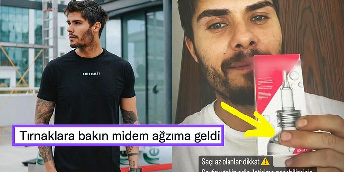 Eski Survivor Yarışmacısı Barış Murat Yağcı'nın Kirli ve Bakımsız Tırnakları Gündem Oldu!