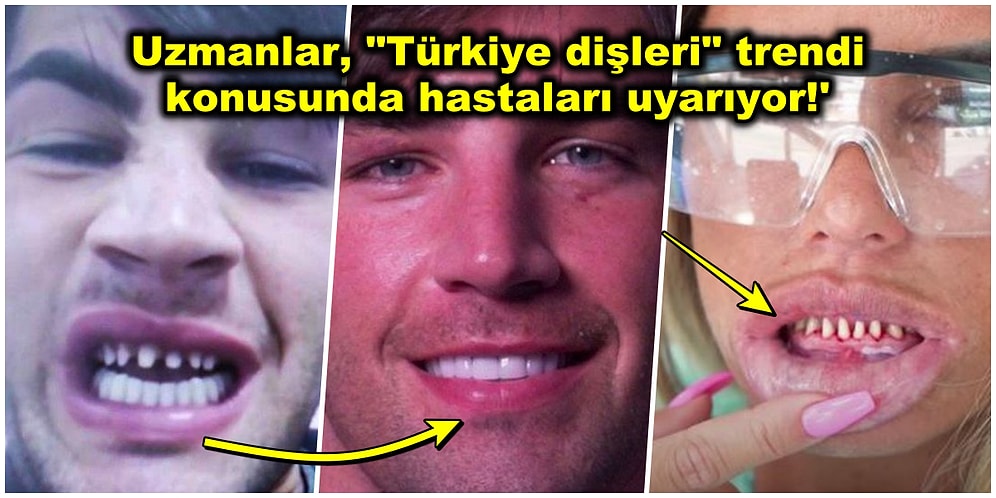 Bayrakları Asamadık! Diş Hekimleri, Ucuza Diş Yaptırmak İçin Ülkemize Gelen Turistleri Uyardı!