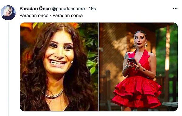 7. Bir Twitter kullanıcısı İrem Derici'nin estetikten önce ve sonraki fotoğrafını paylaşınca ünlü şarkıcıdan yanıt gecikmedi.