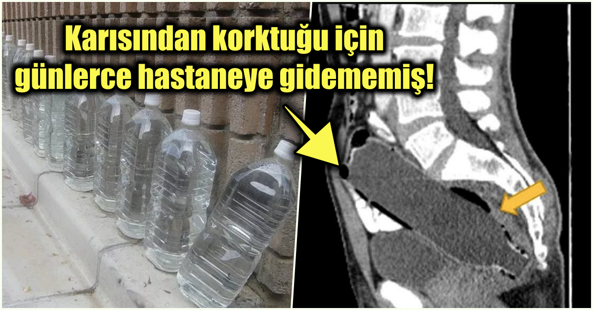 Kocasına Şişe Sokuyor