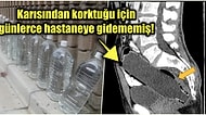 Makatına 19 Santimlik Su Şişesi Sokup Utancından Günlerce Hastaneye Gidemeyen Adamın Bahtsız Hikayesi