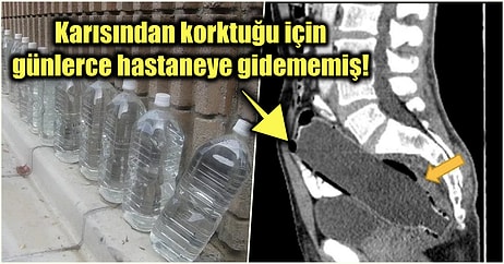 Makatına 19 Santimlik Su Şişesi Sokup Utancından Günlerce Hastaneye Gidemeyen Adamın Bahtsız Hikayesi