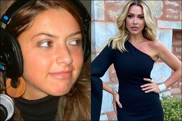 10. Biricik Hadise'mize aşk mı yaradı yoksa estetikler mi çoğaldı dersiniz?