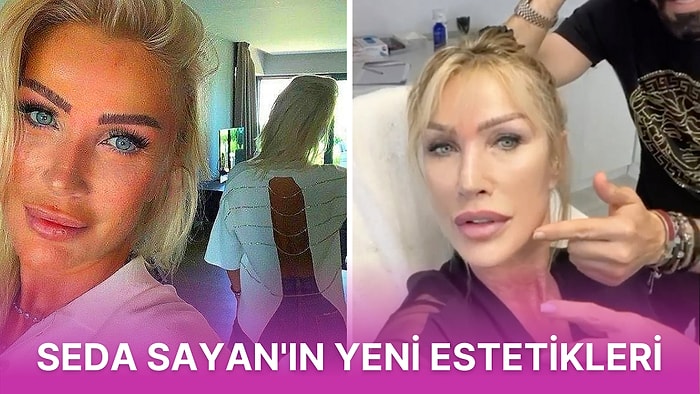 Estetik Yaptırmalara Doyamayan Çiçeği Burnunda Gelin Seda Sayan Yeni Estetikleri ve Değişimiyle Çok Konuşuldu!