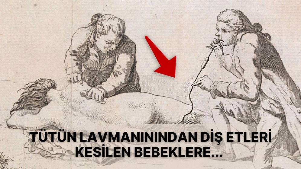 Uygulandığı Zamanlarda Yararlı Olduğu Düşünülen Ama Ölümcül Sonuçlar Doğuran Dehşet Verici 10 Tedavi Yöntemi