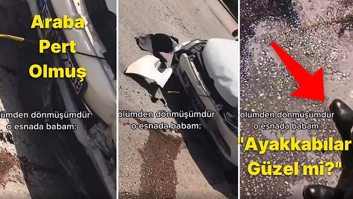 Trafik Kazası Yapıp Ölümden Dönen Kızına 'Ayakkabılarım Güzel mi?' Diye Soran Baba