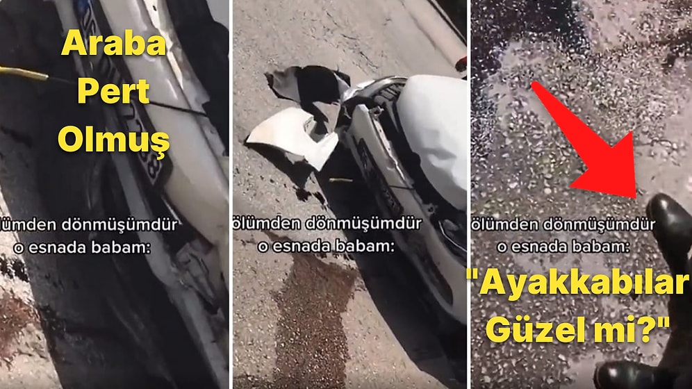 Trafik Kazası Yapıp Ölümden Dönen Kızına 'Ayakkabılarım Güzel mi?' Diye Soran Baba