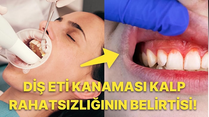 Ağız Sağlığımız Kalp Rahatsızlığından Kansere Kadar Birçok Hastalık Hakkında Fikir Veriyor!