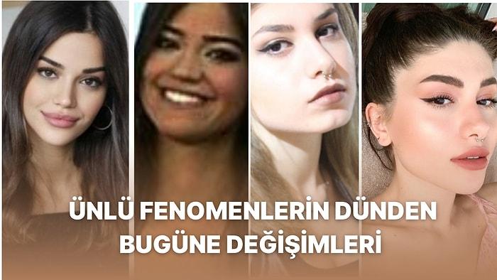Danla Bilic ve Kerimcan Durmaz'ın Estetik Mucizesi: Türkiye'deki Fenomenlerin Dünden Bugüne Değişimleri