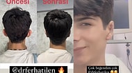 Estetikle Bambaşka Birine Dönüşen TikTok Fenomeni Taha Duymaz Şimdi de Kulaklarından Operasyon Geçirdi