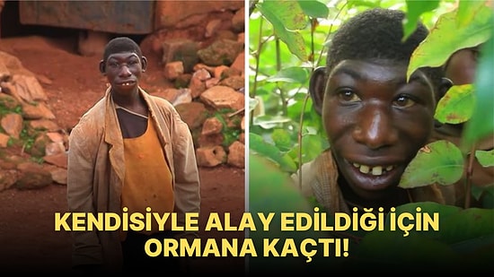 Dış Görünüşü Yüzünden İnsanlardan Kaçıp Vahşi Doğada Yaşayan Genç Adamın Hayata Dönüş Hikayesi