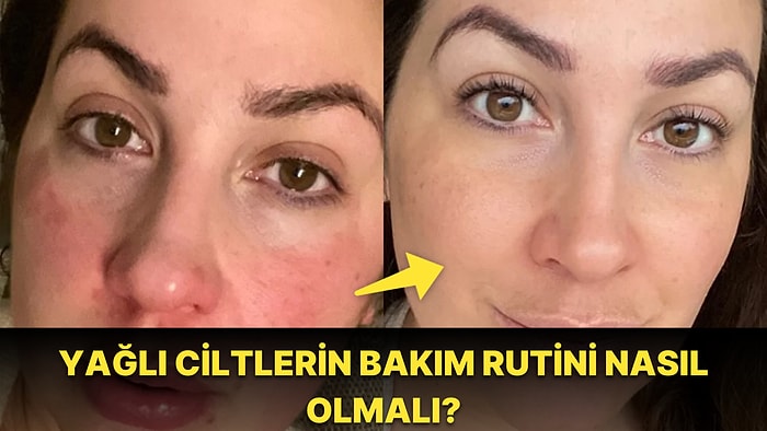 Yağlı Ciltler İçin Bakım Ürünü Tavsiyeleri