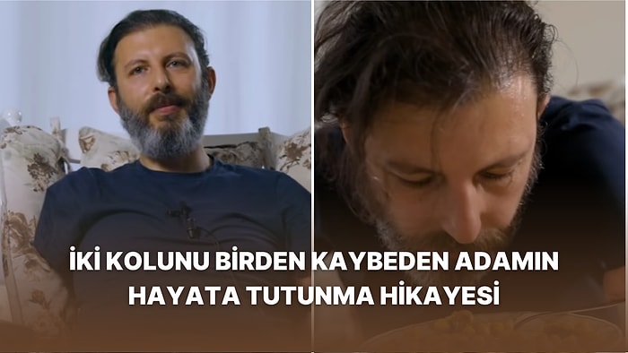 30 Yaşındayken İki Kolunu da Kaybeden Adamın İlham Veren Hayata Tutunuş Hikâyesi