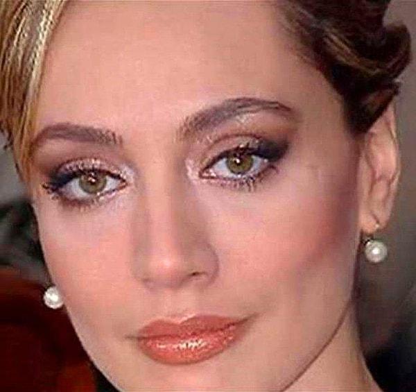 Umut Akyürek zamanla yaptırdığı estetiklerle bambaşka birine dönüştü ve resmen Angelina Jolie'nin ikizi hâline geldi.