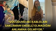 Görülen Engeli Olmadığı İçin Engelli Otoparkına Aracını Koyduktan Sonra Yargılayıcı Sözlere Maruz Kalan Kadın