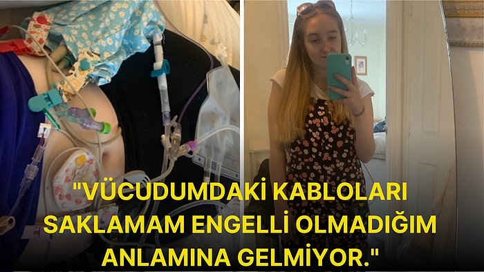 Görülen Engeli Olmadığı İçin Engelli Otoparkına Aracını Koyduktan Sonra Yargılayıcı Sözlere Maruz Kalan Kadın