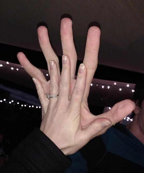 12. Ve son olarak; "15 yaşındaki kuzenim ile eşimin elleri."