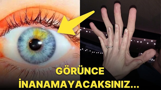 Hiçbir Yerde Görmediğinizi İddia Ettiğimiz Birbirinden Şaşırtıcı Vücut Özelliklerine Sahip Olan Kişiler