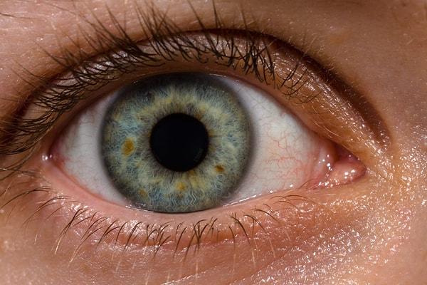 15. Bağışıklık sisteminiz gözlerinizin var olduğunu bilmiyor.