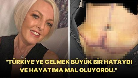 Ameliyat Olmak İçin Ülkemize Gelen Kadın, Dünya Medyasında "Türkiye'ye Sakın Gitmeyin" Uyarısında Bulunuyor