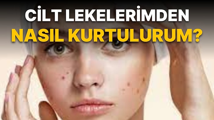 Cilt Lekelerine Çok İyi Geldiği Söylenen Gece Losyonları