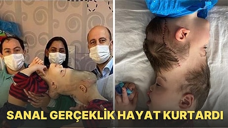 Kafalarından Yapışık Olan İkizler Uzay Çağı Teknolojisiyle 27 Saatlik Operasyonla Birbirlerinden Ayrıldı!