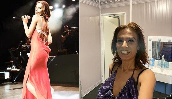 Konserlerindeki kıyafet seçimleriyle ve dans şovlarıyla sürekli gündem olan Yıldız Tilbe, önceki akşam İstanbul'da sahne aldı.