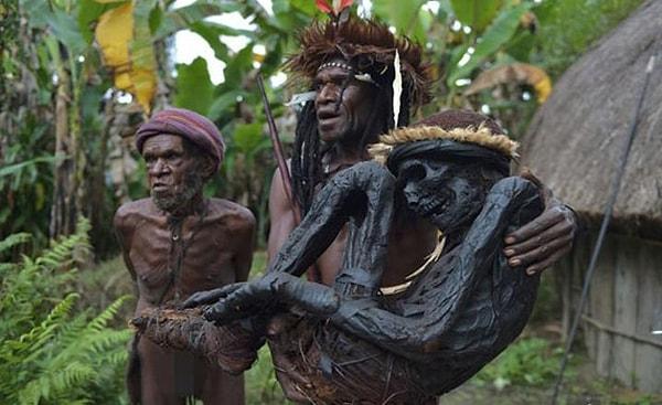 Kuru Hastalığı: Papua Yeni Gine'nin kabile bölgelerine endemik bir dejeneratif nörolojik bozukluk