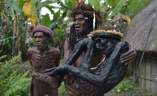 Kuru hastalığı: Papua Yeni Gine'nin kabile bölgelerine özgü dejeneratif bir nörolojik bozukluk