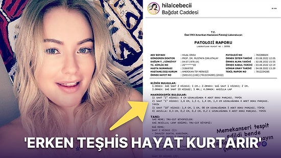 Ünlü Şarkıcı Hilal Cebeci Sağlık Durumu ile İlgili Kötü Haberi Verdi: 'Bende Meme Kanseri Tespit Edildi'