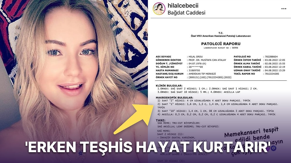Ünlü Şarkıcı Hilal Cebeci Sağlık Durumu ile İlgili Kötü Haberi Verdi: 'Bende Meme Kanseri Tespit Edildi'