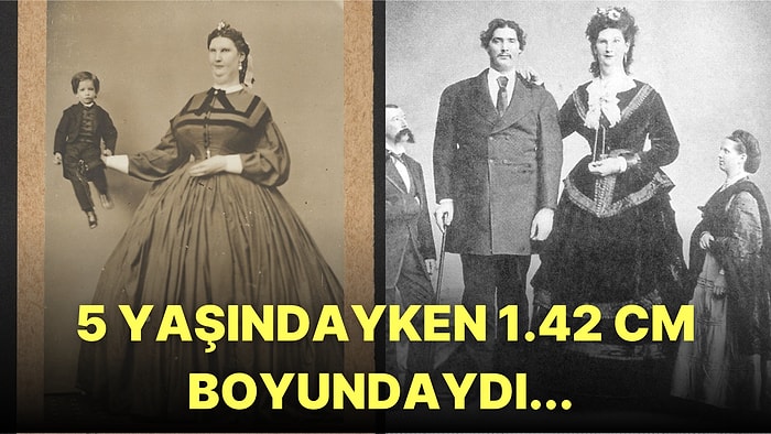 Dünyanın En Büyük Vajinasına Sahip Kadınının Akıllara Durgunluk Veren Hayat Hikayesi