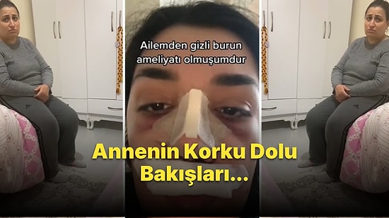 Ailesinden Gizli Burun Ameliyatı Olan Kadın, Ailesinin Tepkisini Kaydetti: 'Her S*ki Yedik Bir Burun Kaldı'