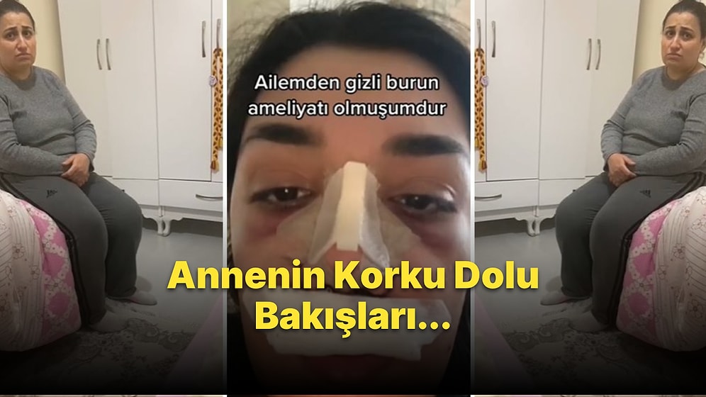 Ailesinden Gizli Burun Ameliyatı Olan Kadın, Ailesinin Tepkisini Kaydetti: 'Her S*ki Yedik Bir Burun Kaldı'