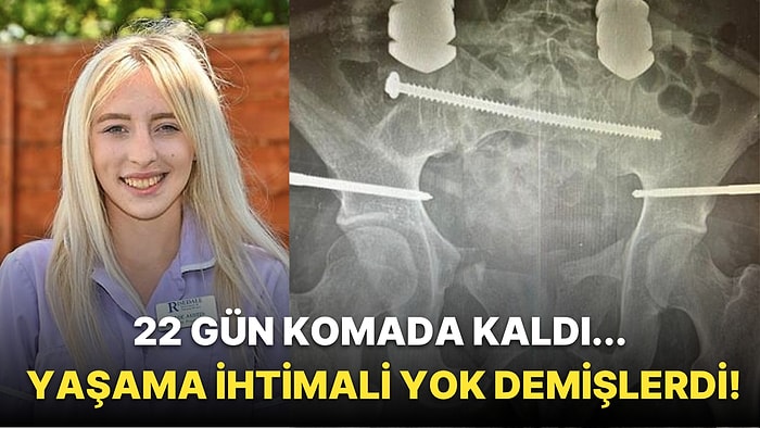 Yaşama İhtimali Yok Demişlerdi! Vücudu Neredeyse Ortadan İkiye Ayrılan Kadının İlham Veren Yaşam Mücadelesi