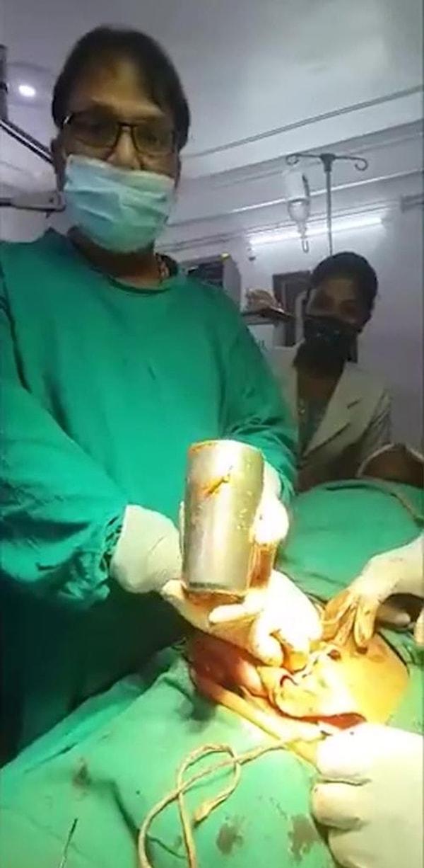 Jaunpur’daki hastanede çekilen röntgenin ardından adamın içinde bir adet bardak olduğu görüldü ve doktorlar şoka girdiler.