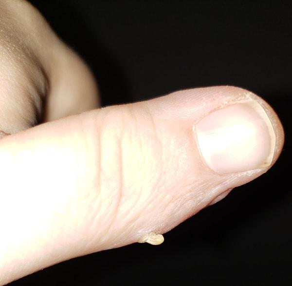 8. "Sol elimde 6 parmak ile doğmuşum. O parmağın tırnağı hala küçük bir pençe gibi elimden uzamaya devam ediyor."