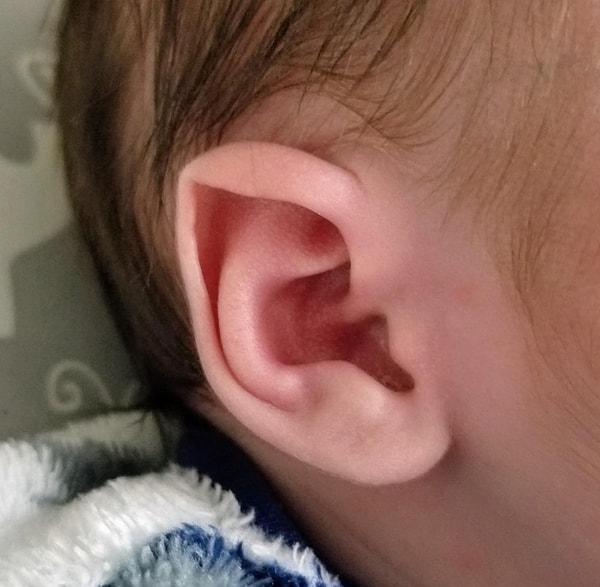 13. "Oğlum doğuştan elf kulaklarıyla doğdu."
