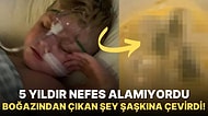 Yanlış Teşhis Konduğu İçin Yıllardır Rahat Nefes Alamayan Çocuğun Boğazından Çıkan Şeye İnanamayacaksınız!