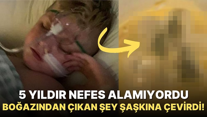 Yanlış Teşhis Konduğu İçin Yıllardır Rahat Nefes Alamayan Çocuğun Boğazından Çıkan Şeye İnanamayacaksınız!