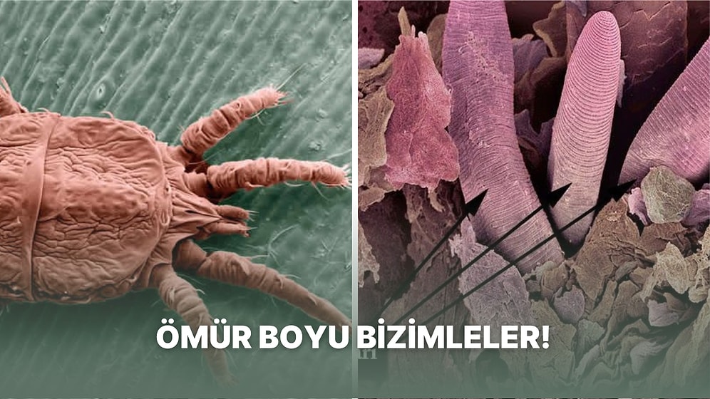 Şu Anda Vücudunuzda Binlerce Organizmanın Yaşadığını Biliyor muydunuz?