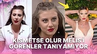 Kısmetse Olur'un Fişnikçi Başı Melis Buse Betkayan'ın Son Hali Görenleri Hayrete Düşürdü!