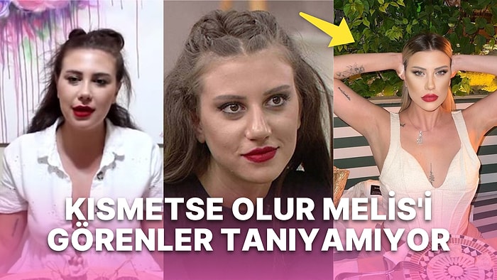 Kısmetse Olur'un Fişnikçi Başı Melis Buse Betkayan'ın Son Hali Görenleri Hayrete Düşürdü!